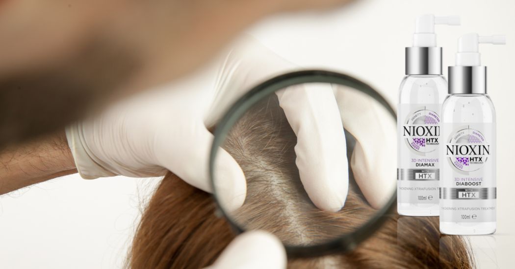 Is Nioxin Good for Psoriasis