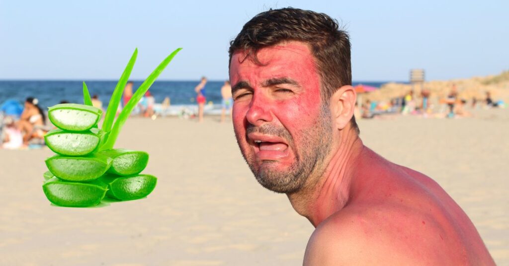 How Long Does Sunburn Last With Aloe