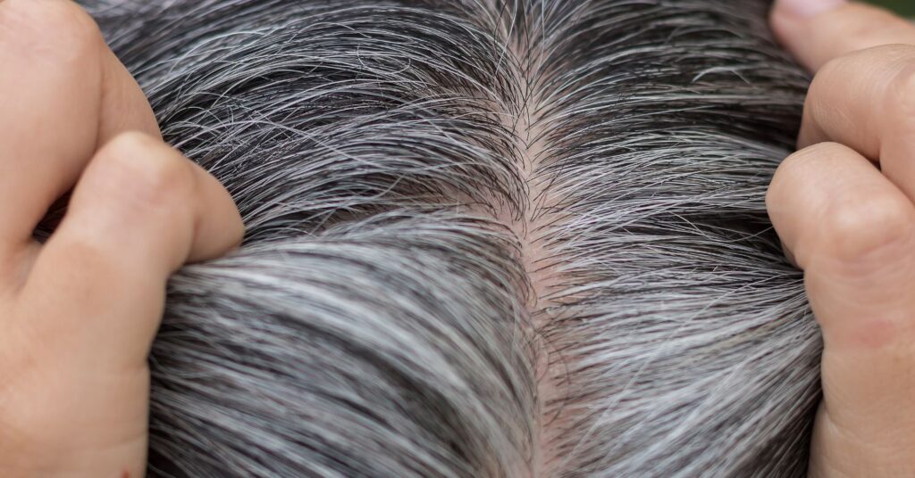 Does Grey Hair Itch