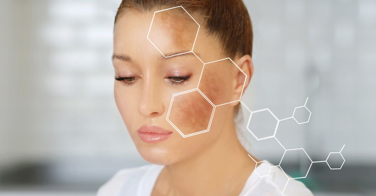 What Vitamin Do You Need For Dark Spots