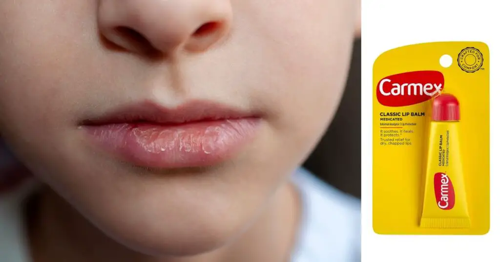 Is Carmex Good For Dry Lips