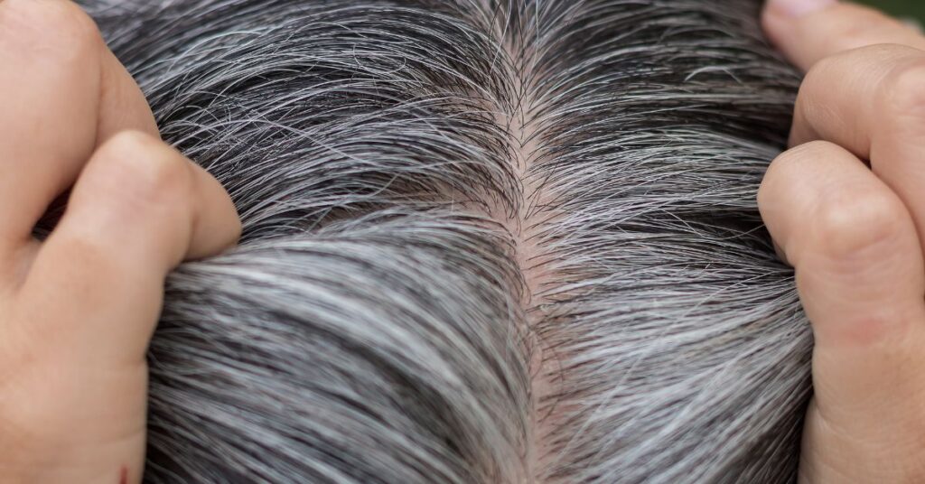 Why Is My Grey Hair Breaking Off